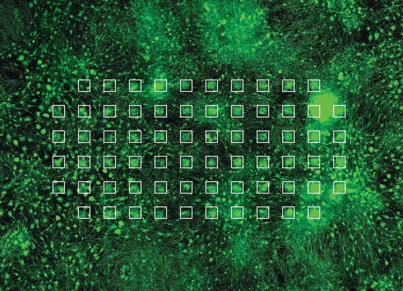 Neuronen, die auf einem MEA gewachsen sind und ein Netzwerk gebildet haben (grün). Die einzelnen Elektroden der MEA sind mit weissen Quadraten hervorgehoben. (© Stephen Jenkinson, Institut für Infektionskrankheiten.)