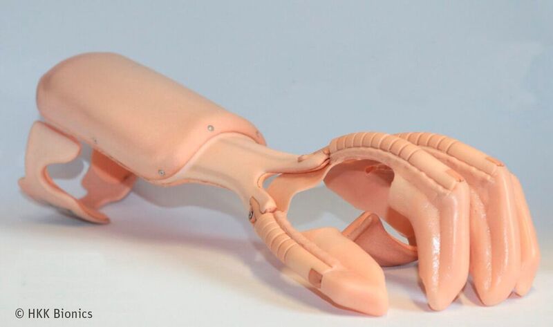 Die Hand-Orthese Exomotion soll helfen, die Greifkraft gelähmter Hände wiederherzustellen. (HKK Bionics)
