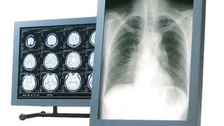 Das von JVC Kenwood entwickelte LCD-Display setzte vor 25 Jahren neue Standards bei der medizinischen Bildgebung. (Bild: JVC Kenwood)