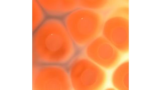 Staphylococcus-aureus-Bakterien auf Nährboden (Bild: Grunert/Vetmeduni Vienna)