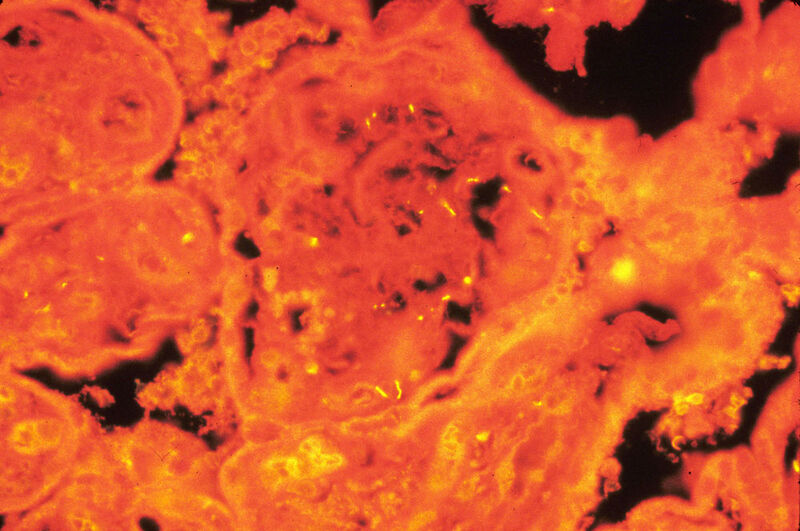 Elektronenmikroskop-Aufnahme eines Treponema-Bakteriums zwischen zwei Wirtszellen. (Steven J. Norris, UTHealth McGovern Medical School, Houston/USA)