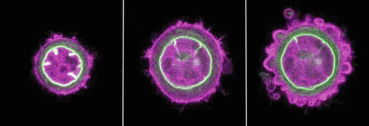Eine Zelle unter dem Rasterkraftmikroskop: Links im Grundzustand, Mitte und rechts in Blickrichtung zusammengedrückt. Die Hülle des Zellkerns ist grün sichtbar, das Protein Actin violett.