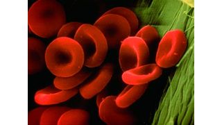 Abb. 1 Rote Blutzellen bilden die Grundlage für das Invitek Invimag Blood Mini Kit/KFml zur Isolation genomischer DNA aus Vollblut. (Archiv: Vogel Business Media)