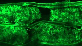 Arbuskuläre Mykorrhizastrukturen innerhalb der Wurzelrindenzellen von L. japonicus. (Bild: Kiran Raj, IPB, modifiziert von Raj et al. Science Advances)
