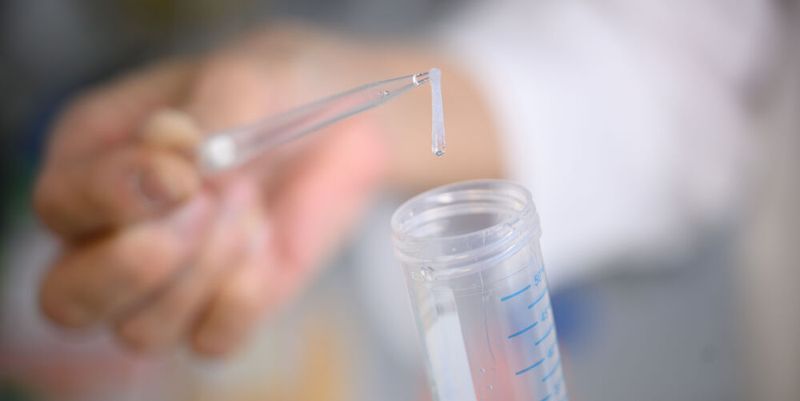 Bei der Genanalyse von 693.869 Menschen europäischer Abstimmung fand das Studienteam die bislang größte Anzahl genetischer Zusammenhänge mit Angstzuständen. (Bild:  © Daniel Peter / UKW)