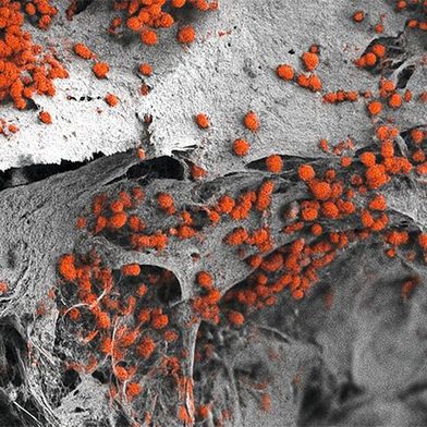 Rasterelektronenmikroskopische Aufnahme des künstlich hergestellten 3D-Knochenmarkgewebes, das mit menschlichen Blutzellen (rot) besiedelt ist.  (Bild: Andrés García García, Universität Basel, Departement Biomedizin)