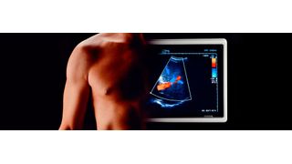 Die Herzultraschall-Software soll das medizinische Personal durch die Erfassung von Herzultraschallbildern führen. Diese wurde mithilfe von maschinellem Lernen entwickelt, damit  zwischen akzeptabler und nicht akzeptabler Bildqualität unterschieden werden kann (antoniotruzzi - stock.adobe.com)