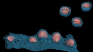 Neu gebildete HI-Viren verlassen als kugelförmige Kapsel die Zelle. (Grafische Darstellung einer Rekonstruktion der HIV-Freisetzung mittels Elektronen-Tomographie; blau: Membran, rot: Proteinkapsel; Bild: Universitätsklinikum Heidelberg) (Archiv: Vogel Business Media)