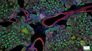 Webinar Listing: Carl Zeiss (Carl Zeiss)