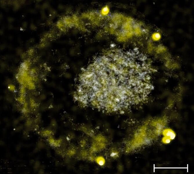 Das Bakterium C. metallidurans bildet winzig kleine Goldnuggets. (American Society for Microbiology)