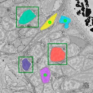 Segmentierung von elektronenmikroskopischen Bildern mit μSAM. Das Bild zeigt, wie das Modell Zellkerne segmentiert mithilfe von Punkten und Kästchen und den entsprechenden vom Modell vorhergesagten Masken. (Bild:  Anwai Archit mit dem Tool μSAM)
