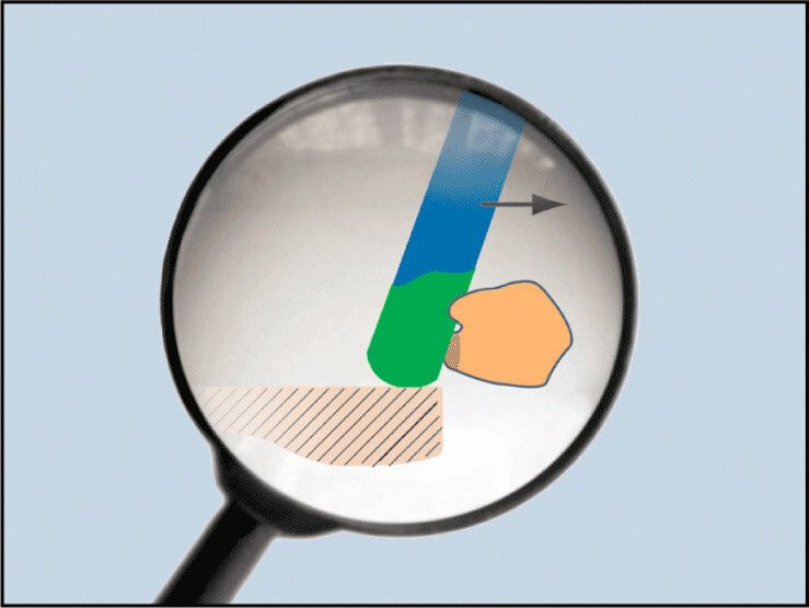 Bild 2: Die mechanische Wirkung der Schwertbürste und die Ingromat-Flüssigkeit sorgen gemeinsam für das zuverlässige Entfernen der Partikel. (Bild: Wandres GmbH)