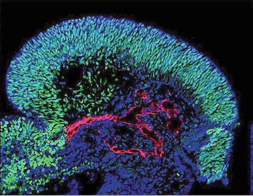 Organoidmodelle mit einer teils verblüffenden Ähnlichkeit zu echten embryonalen Geweben: Gehirn-Organoid mit Blutgefäßen (rot) und Gehirnstammzellen (grün) (JMU, Institut für Anatomie und Zellbiologie)