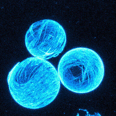 Künstliches Minimalmodell für Zellverformungen. Die eingeschlossenen Biomoleküle bilden eine aktive Schicht an der Membran, die eine fortwährende Bewegung antreibt. (Bild: Keber, Loiseau, Sanchez, Bausch/TUM)