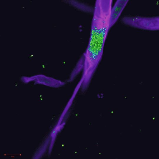 Mikroskopische Visualisierung der Bakterien im Pilz Mikroskopische Visualisierung der Bakterien im Pilz