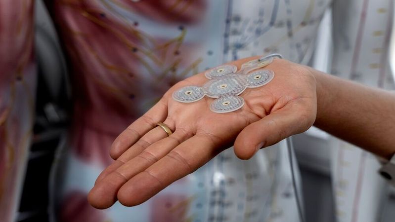 Das minimalinvasive Stimulationsimplantat von Precisis soll neuronale Signale künftig direkt im Körper auswerten und Therapieimpulse in Echtzeit anpassen – Edge-KI wird damit Teil medizinischer Infrastruktur.(Bild:  Precisis)