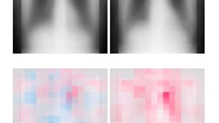 The upper images are the chest radiographs of patients from 21 to 40 years old and from 81 to 100 years old chronologically and the lower images are a visualization of the AI’s focus (both after averaging). Red indicates the points most useful for age determination. (Source: Yasuhito Mitsuyama, OMU)