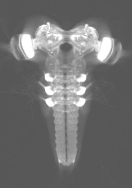 Lichtmikroskopische Aufnahme des Gehirns einer Fliegenlarve (Dr. Katharina Eichler/Universität Konstanz  )