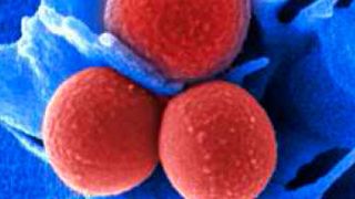 Elektronenmikroskopische Aufnahme von Staphylococcus aureus.  (© HZI/Manfred Rohde)