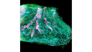 Vascular and glomeruli details of the human kidney. (Helmholtz Zentrum München / Ertürk lab)