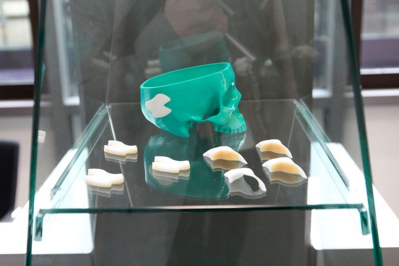 Der Freeformer zeigt sich auch für die Herstellung individueller Implantate geeignet...Interessant auch bei der Anwendung von resorbierbaren Kunststoffen. (Königsreuther)