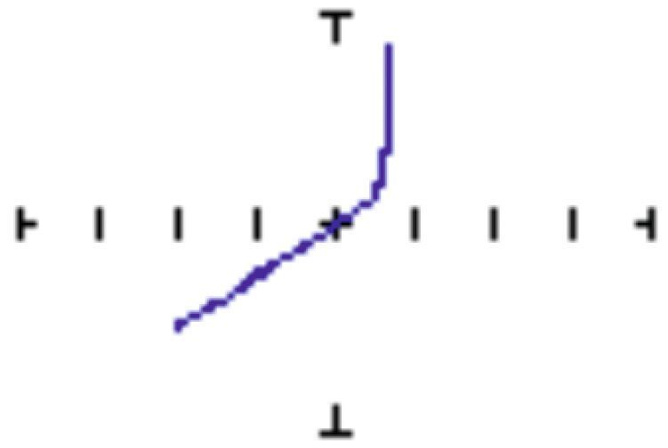 Bild 4: Eine Diode mit Leckstrom. Die Spannung muss erhöht werden, Durchbruch der Dioden-Kennlinie zu erkennen. Ein Stromfluss im Sperrbereich zeigt einen Leckstrom an. Wird die Spannung unterhalb des Durchbruchs angelegt, verschwindet die Diode virtuell aus der Schaltung. Dies ermöglicht das Verhalten des „verbleibenden“ Netzwerks zu betrachten. Wird die Spannung bei Z-Dioden erhöht, wird die Zener Spannung sichtbar. (Huntron Inc. USA)