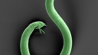 Eine elektronenmikroskopische Aufnahme eines männlichen Fadenwurms. (Bild: : Hinrich Schulenburg, Aufnahme: Antje Thomas)