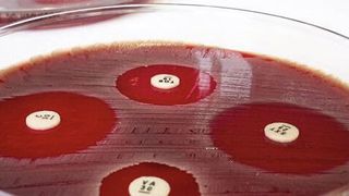 Der Agardiffusionstest macht Antibiotika-Resistenzen sichtbar. (DZIF/Fabian Grein)
