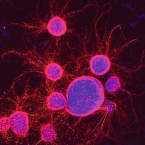 Embryonale Stammzellen der Maus, die eine elektrochemische Spezialisierung durchlaufen, mit Markierungen für Zellkerne (blau) und Neuronenprojektionen (rot) 