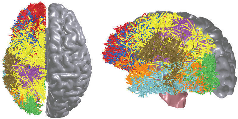 Vorbild für den „denkenden Chip“ ist das menschliche Gehirn, Bild: IBM (Archiv: Vogel Business Media)