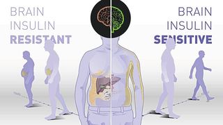 Reagiert das Gehirn empfindlich auf Insulin, nimmt man deutlich ab, reduziert ungesundes Bauchfett und kann auch langfristig das Gewicht halten. Reagiert das Gehirn nur wenig oder gar nicht auf Insulin, verliert man nur zu Beginn der Maßnahme etwas Gewicht und nimmt dann wieder zu. Quelle: IDM (Bild: DZD, IDM)
