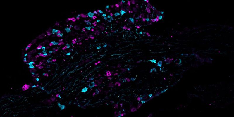 Schnitt durch ein Spinalganglion einer Maus, in dem zwei unterschiedliche Typen von Schmerzrezeptoren in Cyan (türkis) und Magenta (pink) angefärbt sind.(Bild:  Sampurna Chakrabarti, Max Delbrück Center)