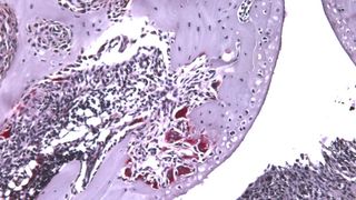 Möglicher Ansatzpunkt für Therapie von rheumatoider Arthritis – Wirkung von Myostatin auf die Knochen abbauenden Osteoklasten (hier rötlich-braun dargestellt). (Bild: B. Dankbar)