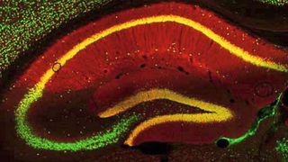 In Mäusegehirnen haben Forscher einen Signalweg entdeckt, der Übergewicht begünstigt. Die Nervenzellen des Mäusegehirns sid hier grün und das menschliche Protein PRG-1 rot dargestellt. Wenn die Nervenzellen PRG-1 enthalten erscheinen die Zellen in gelb. (Bild: Johannes Vogt)