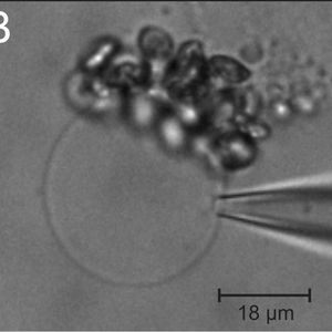 Zelle aus einem Blatt der Ackerschmalwand (Arabidopsis thaliana), befreit von ihrer Zellwand (A). Wird auch noch die Zellmembran entfernt, bleibt die große Vakuole übrig (B), die dann für Pumpstrommessungen mit der Patch-Clamp-Technik zugänglich ist. Gibt man ATP als Energielieferanten hinzu, steigt der Transport von Protonen in die Vakuole an (C).  Bild: Rainer Hedrich