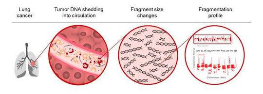 Illustration representing the DNA Evaluation of Fragments for Early Interception (DELFI) approach for lung cancer detection through non-invasive assessment of cell-free DNA fragmentation profiles.(Source:  Cancer Discovery)