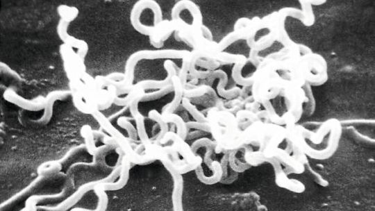Elektronenmikroskopische Aufnahme von Treponema pallidum(Bild:  CDC/Dr. David Cox)