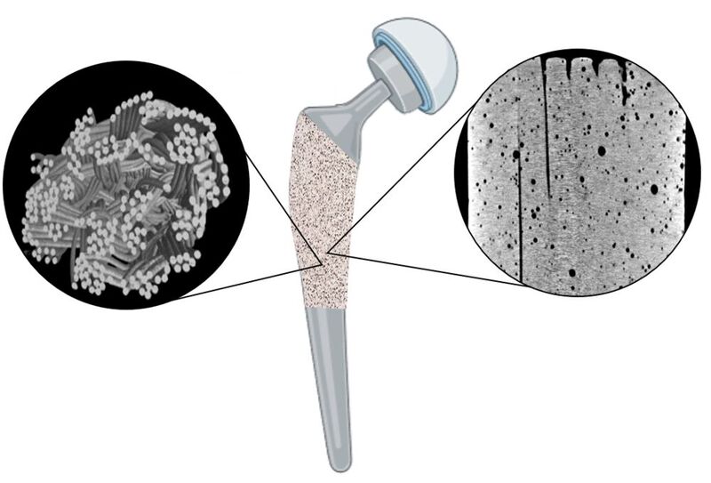 ITA-Forscher präsentieren auf der Techtextil erstmals Zwischenergebnisse aus einem Forschungsprojekt für eine textile Hüftgelenkprothese – sie soll dank textiler Faserstruktur (links) und poröser Oberfläche (rechts) das Einwachsen in den Knochen erleichtern.