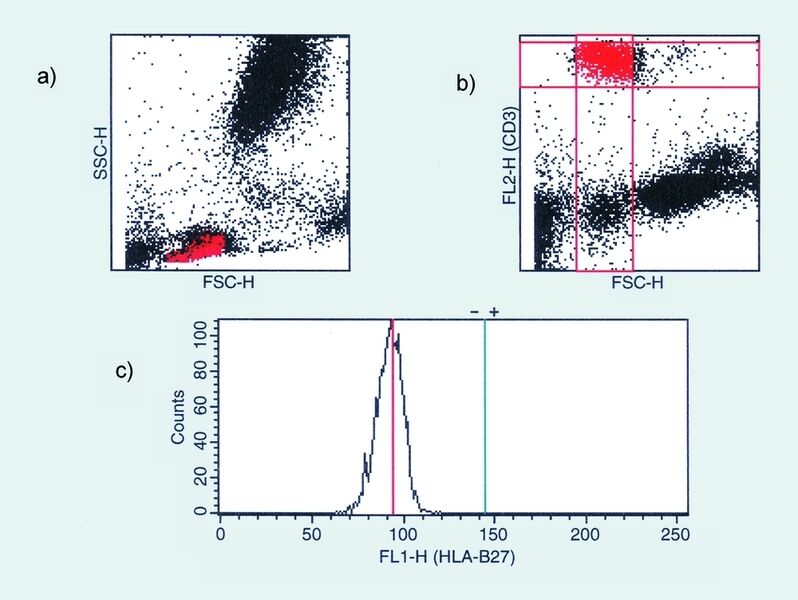 Abb. 1  Durchflusszytometrischer Nachweis des HLA-B27-Antigens auf T-Lymphozyten. a: Darstellung von Zellgranularität gegen Zellgröße der Leukozyten einer Blutprobe. Blutzelle und Zelltrümmer sind jeweils als Punkt dargestellt; b: Rote Fluoreszenzintensität gegen Leukozytenzellgröße derselben Blutprobe; c: Histogramm der grünen Fluoreszenzintensität auf den T-Lymphozyten.Ergebnis: HLA-B27-negative Blutprobe; Die T-Lymphozyten haben HLA-B27-Antikörper nicht spezifisch gebunden und fluoreszieren nur schwach. Median der Fluoreszenz FL1 = 95. (Archiv: Vogel Business Media)