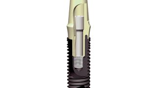 Das Vollkaskoimplantat Perio-Type X-Pert von Clinical House gibt es mit einem Implantatschutzbrief, der Patienten eine 10-Jahres-Garantie auf Implantatersatz zusichert. Bild: Clinical House Europe (Archiv: Vogel Business Media)