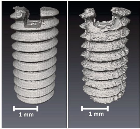 Links ist die Schraube vor dem Abbauversuch zu sehen. Rechts im Bild dieselbe Schraube nach 56 Tagen in-vitro ohne die Degradationsprodukte. Deutlich zu sehen ist hier der Abbau durch die Korrosion. Die Oberfläche hat sich verändert.(Bild:  Krüger et. al 2021)