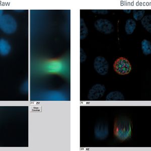Abb. 1: Blind Deconvolution: Menschliche Drüsenkrebszellen wurden in einem Z-Stapel abgebildet. Nach der Blind Deconvolution nimmt die Unschärfe ab. Außerdem kann der Kontrast gesteigert werden und die Intensität erhöht sich.