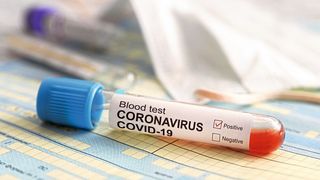 Arbeitgeber müssen auf der einen Seite ihre Belegschaft schützen, auf der anderen Seite müssen sie darauf achten, dass sie die Lohnkosten für ausgefallene Mitarbeiter erstattet bekommen. (Bild: ©diy13 - stock.adobe.com)