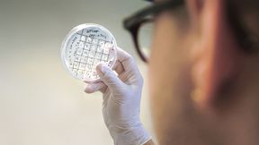 Auf der Suche nach dem optimalen Mikrobenstamm: Die Forschenden entwickeln im Projekt Carboncare Bakterien, die chemische Grundstoffe nachhaltig herstellen.
 (Bild: Charité/ Stefan Hristov)