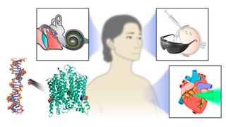 ChReef (ChR that excites efficiently) wurde durch die gezielte Veränderung des genetischen Bauplans eines lichtempflindlichen Proteins (grüne Struktur; u.l.) für optogenetische Therapien optimiert. Ziel war es, die erforderliche Effizienz und Sicherheit für die Anwendung beim Menschen zu gewährleisten. Das Protein soll die Entwicklung neuer Behandlungsmaßnahmen vorantreiben, und zwar zur Wiederherstellung des Hörens (Optisches Cochlea-Implantat, o.l.), des Sehens (lokale Gentherapie im Auge und spezielle Brille, o.r.) oder zur Regulation des Herzrhythmus (Steuerung der Aktivität der Herzmuskelzellen, u.r.). (Bild: alexey chizhik/ekfz ot)