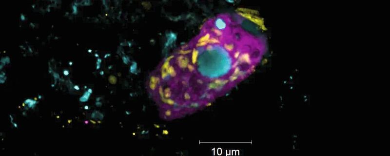 Der Endosymbiont Candidatus Azoamicus mariagerensis und sein Ciliatenwirt unter dem Fluoreszenzmikroskop. Zu sehen sind der Endosymbiont (gelb) und der Ciliat (violett). Der Zellkern des Ciliaten ist mit einem DNA-Farbstoff (blau) angefärbt.(Bild:  MPI f. marine Mikrobiologie/ Linus Matz Zeller)