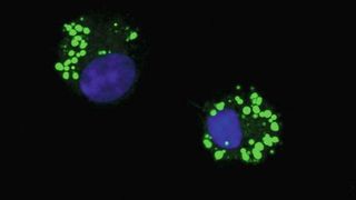 Das Bild zeigt zwei Lymphoid-Zellen (ILC; die Zellkerne sind blau markiert), die in kleinen Fetttröpfchen (lipid droplets, grün) externe Fettsäuren gespeichert haben.  (Bild: © Dr. Fotios Karagiannis/Uni Bonn )