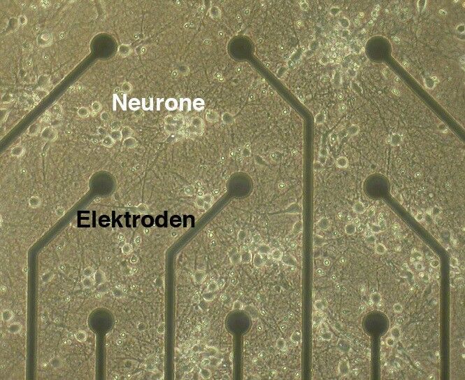 Kultivierte Neuronen auf einem Chip zur Multi-Elektroden-Ableitung: Die Elektroden registrieren die elektrischen Impulse der Neuronen. (Bild: Institut für Physiologie, Universitätsmedizin Mainz)