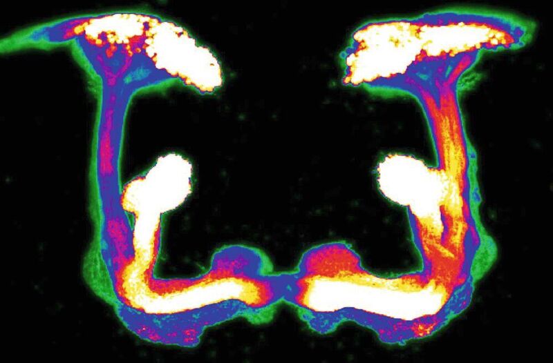 Die Abbildung zeigt die höhere Hirnregion, den sog. Pilzkörper, der Fliege, die sie zum Lernen und Entscheiden benötigt. Dopaminerge Neurone kodieren für wichtige Informationen wie gut oder schlecht, in Bewegung oder still, die wichtig sich um die richtige Entscheidung zu treffen. (Siju Purayil / TUM)