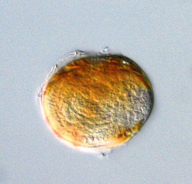 Dinoflagellat Alexandrium, der vom Parasiten Amoebophrya befallen ist, unter dem Lichtmikroskop. (Yameng Lu)